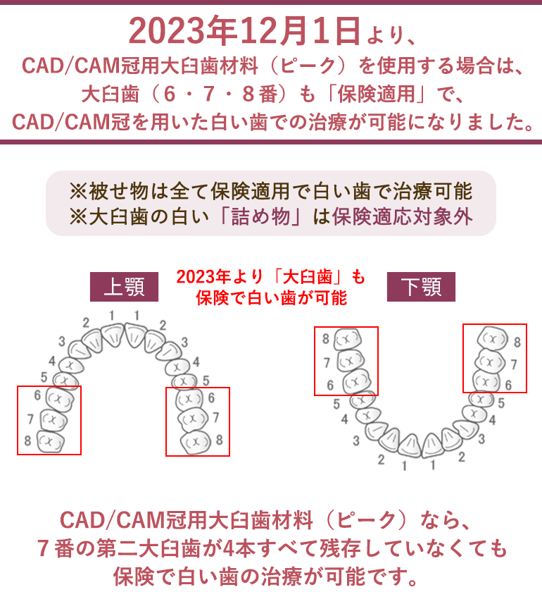CAD/CAM冠対応口腔図